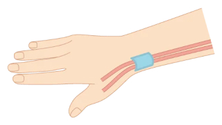 腱鞘のイラスト