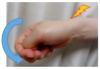 手首を小指側に曲げた画像