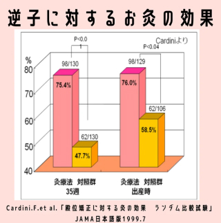 逆子に対するお灸の効果