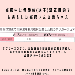 妊娠中に骨盤位矯正目的でお灸をした妊婦さんの赤ちゃん